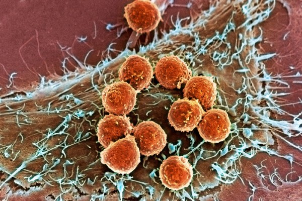 t-lymphocytes-and-cancer-cell-sem-spl
